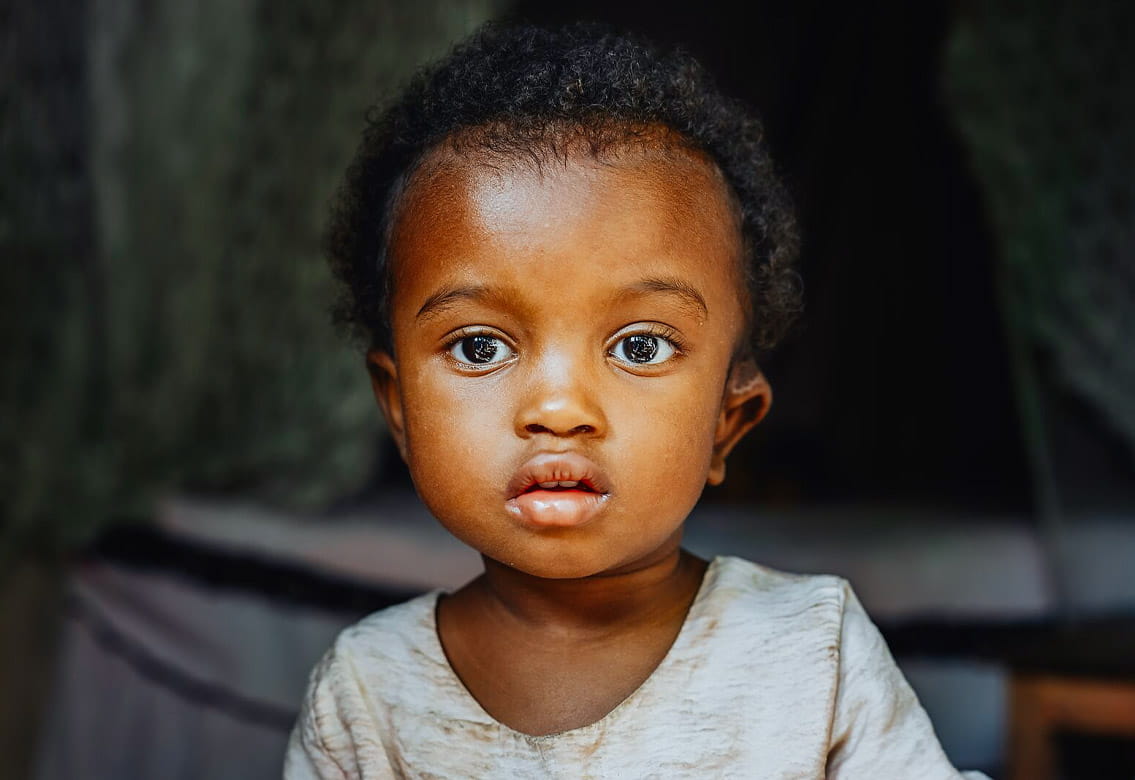 Armella, patiente maxillo-faciale